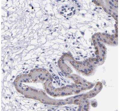 Immunohistochemistry-Paraffin: P-Cadherin Antibody [NBP1-85707]
