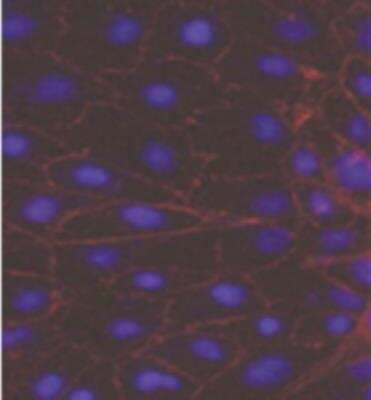 Immunocytochemistry/ Immunofluorescence: P-Cadherin Antibody (MM0508-9V11) - Azide and BSA Free [NBP2-11842]