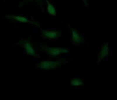 Immunocytochemistry/ Immunofluorescence: P-Cadherin Antibody (OTI2D5) - Azide and BSA Free [NBP2-73267]