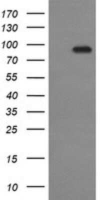 Western Blot: P-Cadherin Antibody (OTI2D5)Azide and BSA Free [NBP2-73267]