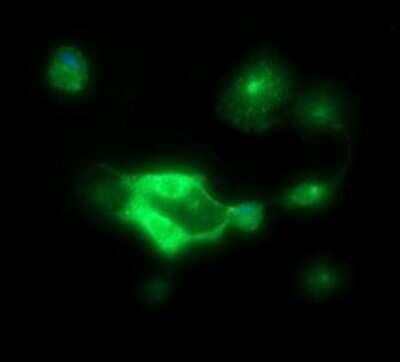 Immunofluorescence: P-Cadherin Antibody (OTI2D5) [NBP2-45601]