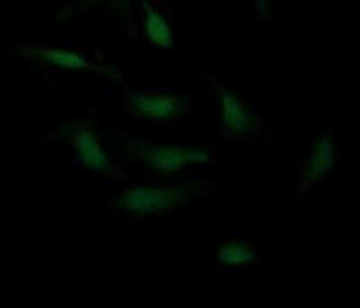 Immunofluorescence: P-Cadherin Antibody (OTI2D5) [NBP2-45601]