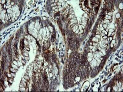 Immunohistochemistry: P-Cadherin Antibody (OTI2D5) [NBP2-45601]