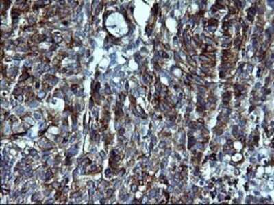 Immunohistochemistry: P-Cadherin Antibody (OTI2D5) [NBP2-45601]