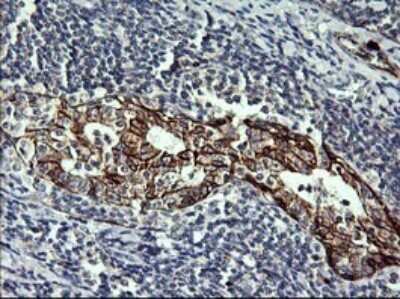 Immunohistochemistry: P-Cadherin Antibody (OTI2D5) [NBP2-45601]