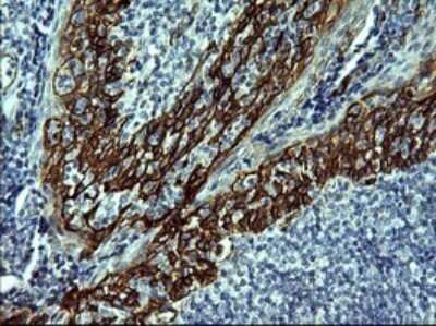 Immunohistochemistry: P-Cadherin Antibody (OTI2D5) [NBP2-45601]