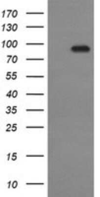 Western Blot: P-Cadherin Antibody (OTI2D5) [NBP2-45601]