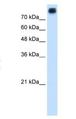 Western Blot: P-Cadherin Antibody [NBP1-59222]