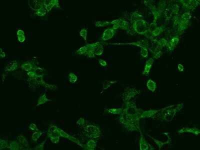 Immunocytochemistry/ Immunofluorescence: P-Rex1 Antibody [NBP2-97481]