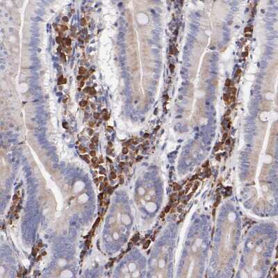 Immunohistochemistry-Paraffin: P-Rex1 Antibody [NBP1-93590]