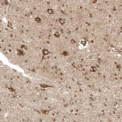 Immunohistochemistry-Paraffin: P-Rex1 Antibody [NBP1-93590]