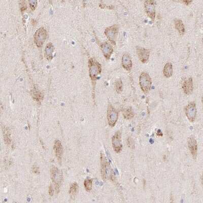 Immunohistochemistry-Paraffin: P-Rex1 Antibody [NBP1-93590]