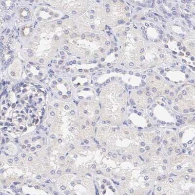 Immunohistochemistry-Paraffin: P-Rex1 Antibody [NBP1-93590]