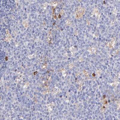 Immunohistochemistry-Paraffin: P-Rex1 Antibody [NBP1-93590]
