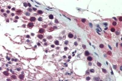Immunohistochemistry-Paraffin: P-Rex1 Antibody [NBP2-27507]