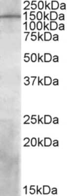 Western Blot: P-Rex1 Antibody [NBP2-27507]