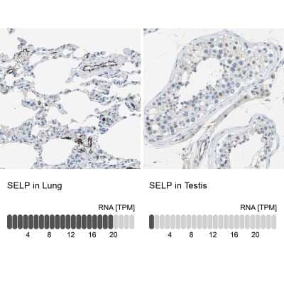 Immunohistochemistry-Paraffin: P-Selectin/CD62P Antibody [NBP1-85744]