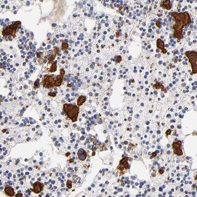 Immunohistochemistry-Paraffin: P-Selectin/CD62P Antibody [NBP1-85745]
