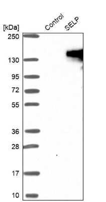 Western Blot: P-Selectin/CD62P Antibody [NBP1-85744]