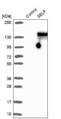 Western Blot: P-Selectin/CD62P Antibody [NBP1-85745]