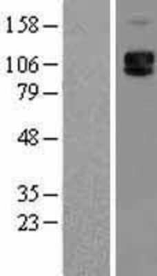 Western Blot: P-Selectin/CD62P Overexpression Lysate [NBL1-15793]