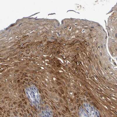 Immunohistochemistry-Paraffin: P11 Antibody [NBP1-82458]