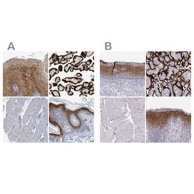 Immunohistochemistry-Paraffin: P11 Antibody [NBP1-82458]