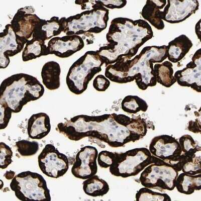 Immunohistochemistry-Paraffin: P11 Antibody [NBP1-82458]