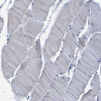 Immunohistochemistry-Paraffin: P11 Antibody [NBP1-82458]