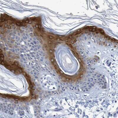 Immunohistochemistry-Paraffin: P11 Antibody [NBP1-82458]