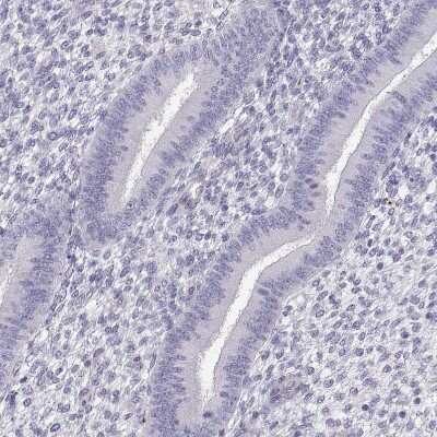 Immunohistochemistry-Paraffin: P11 Antibody [NBP2-55877]