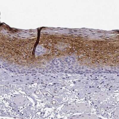 Immunohistochemistry-Paraffin: P11 Antibody [NBP2-55877]