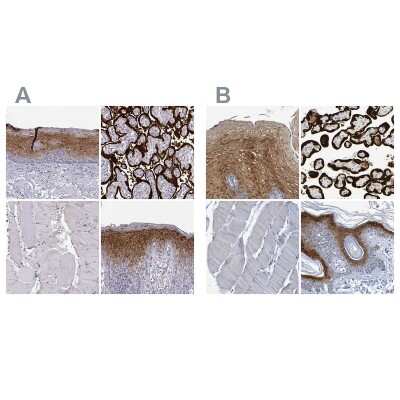 Immunohistochemistry-Paraffin: P11 Antibody [NBP2-55877]