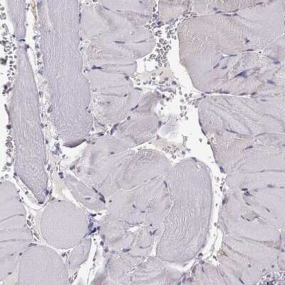 Immunohistochemistry-Paraffin: P11 Antibody [NBP2-55877]