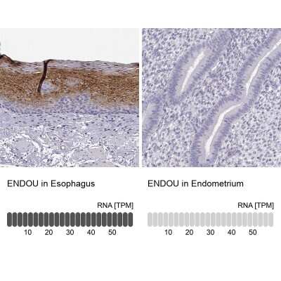 Immunohistochemistry-Paraffin: P11 Antibody [NBP2-55877]