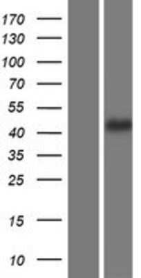 Western Blot: P11 Overexpression Lysate [NBP2-11464]