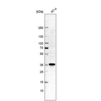 Western Blot: P15RS Antibody [NBP1-87917]