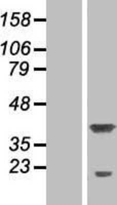 Western Blot: P15RS Overexpression Lysate [NBP2-06863]