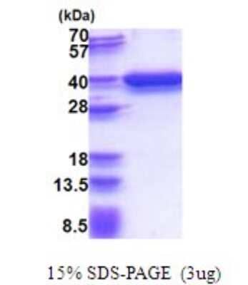 SDS-PAGE: Recombinant Human P15RS His Protein [NBP2-51661]