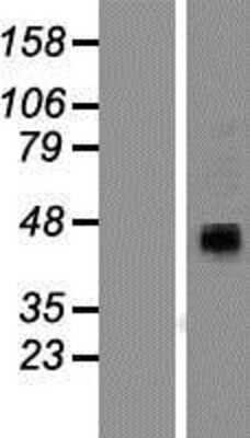 Western Blot: P2X4 Overexpression Lysate [NBP2-08102]