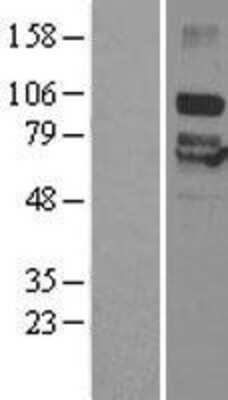 Western Blot: P2X7/P2RX7 Overexpression Lysate [NBL1-14033]