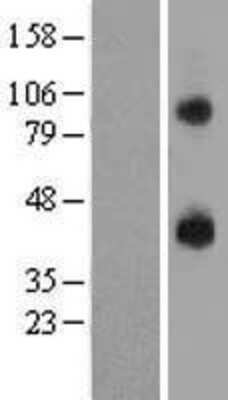 Western Blot: P2Y14/GPR105 Overexpression Lysate [NBL1-14042]