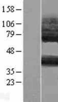 Western Blot: P2Y14/GPR105 Overexpression Lysate [NBL1-14043]