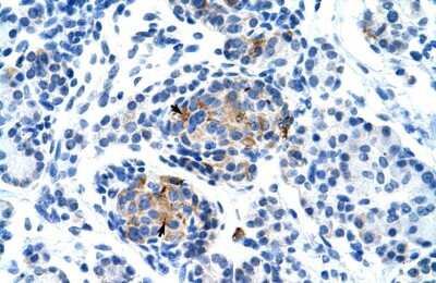 Immunohistochemistry: P2X1/P2RX1 Antibody [NBP2-86742]