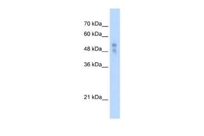 Western Blot: P2X1/P2RX1 Antibody [NBP2-86742]