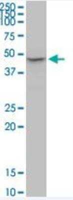 Western Blot: P2X2/P2RX2 Antibody (3D5) [H00022953-M02-100ug]