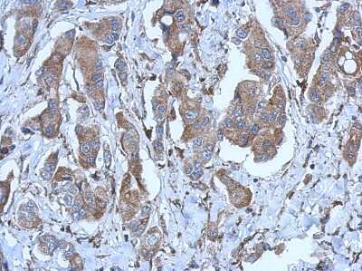 Immunohistochemistry-Paraffin: P2X2/P2RX2 Antibody [NBP2-19656]
