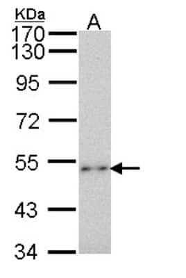 Western Blot: P2X2/P2RX2 Antibody [NBP2-19655]