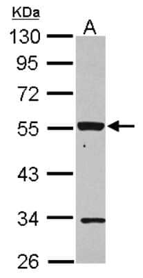 Western Blot: P2X2/P2RX2 Antibody [NBP2-19656]