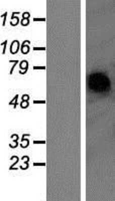 Western Blot: P2X2/P2RX2 Overexpression Lysate [NBP2-05185]